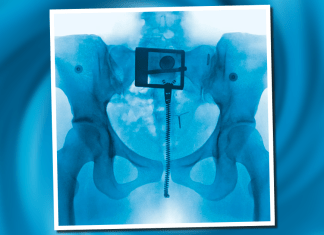 Lorde se reinventa con 'Virgin', su nuevo álbum.- Blog Hola Telcel