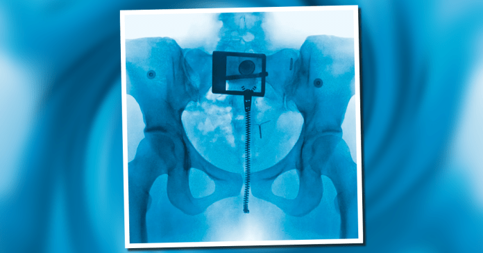 Lorde se reinventa con 'Virgin', su nuevo álbum.- Blog Hola Telcel