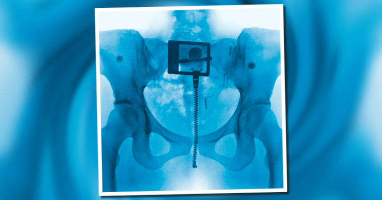 Lorde Lorde se reinventa con 'Virgin', su nuevo álbum.- Blog Hola Telcel